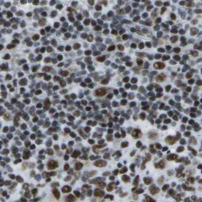 NSRP1 Antibody in Immunohistochemistry (IHC)