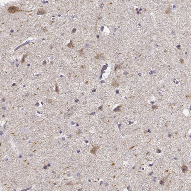 Kiaa0319 Antibody in Immunohistochemistry (IHC)