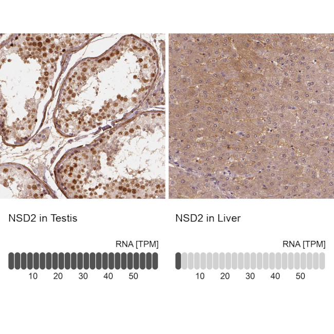 NSD2 Antibody