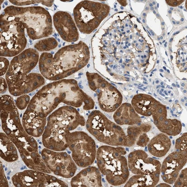 SLC35E1 Antibody in Immunohistochemistry (IHC)