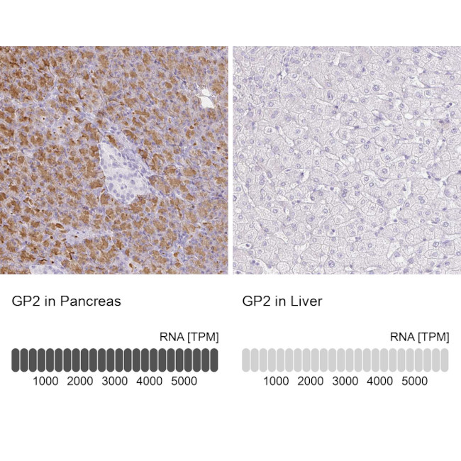 GP2 Antibody in Immunohistochemistry (IHC)