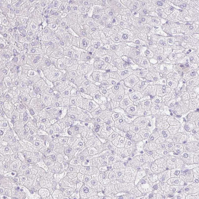 GP2 Antibody in Immunohistochemistry (IHC)