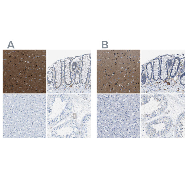 MAPRE2 Polyclonal Antibody (PA5-53484)