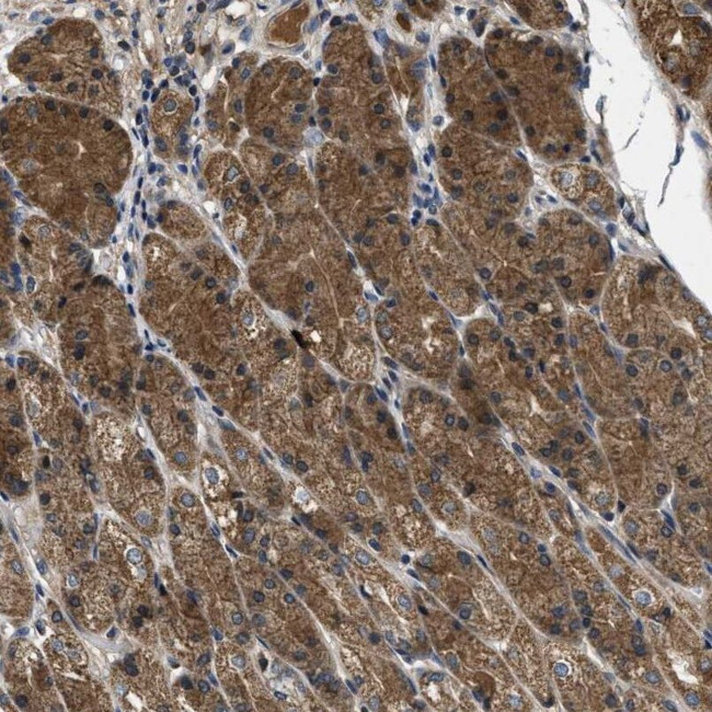 GALK1 Antibody in Immunohistochemistry (IHC)