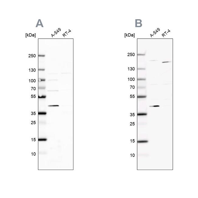 GALK1 Antibody in Western Blot (WB)