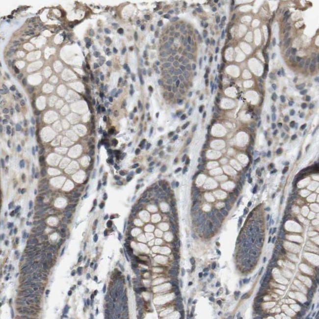 RAB21 Antibody in Immunohistochemistry (IHC)