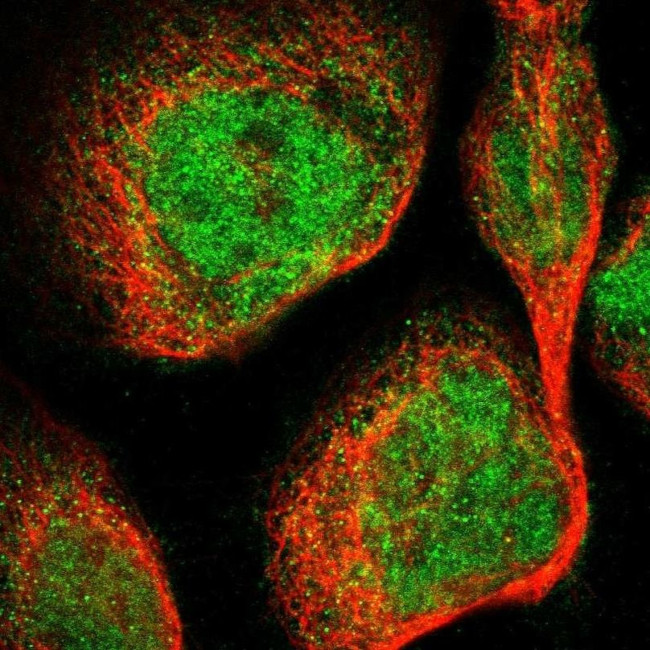 DGKE Antibody in Immunocytochemistry (ICC/IF)