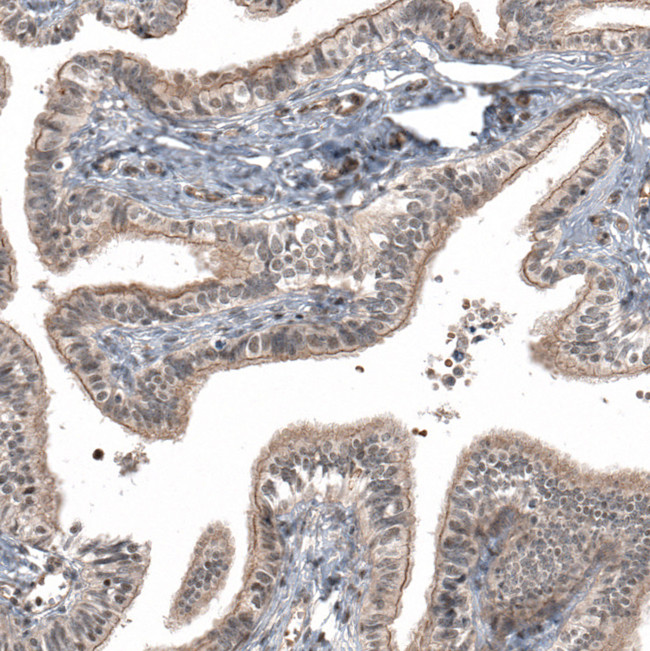 IFNLR1 Antibody in Immunohistochemistry (IHC)