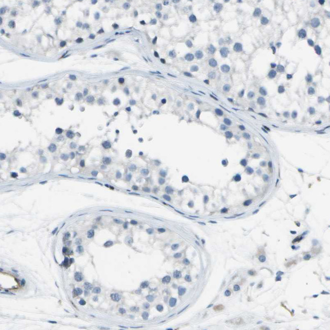 ABI3 Antibody in Immunohistochemistry (IHC)