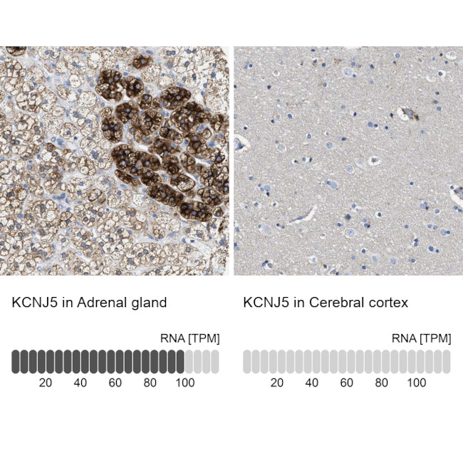 Kir3.4 (KCNJ5) Antibody in Immunohistochemistry (IHC)