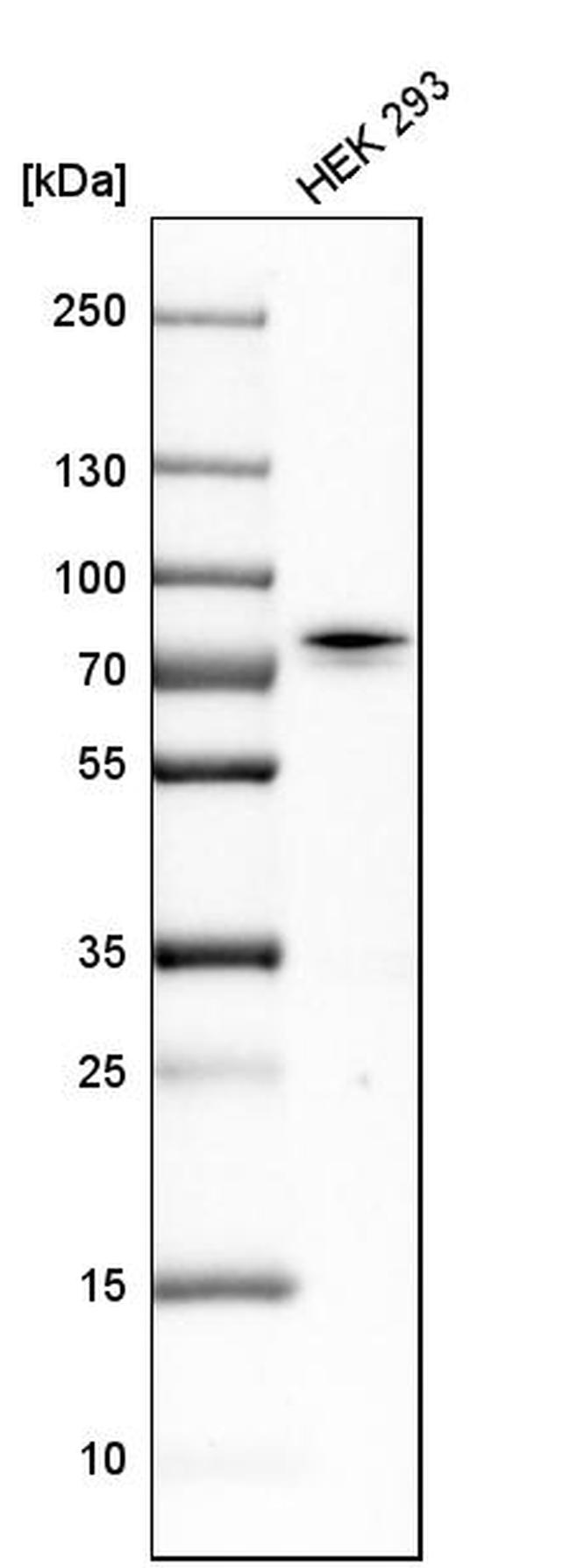 CTPS2 Antibody in Western Blot (WB)