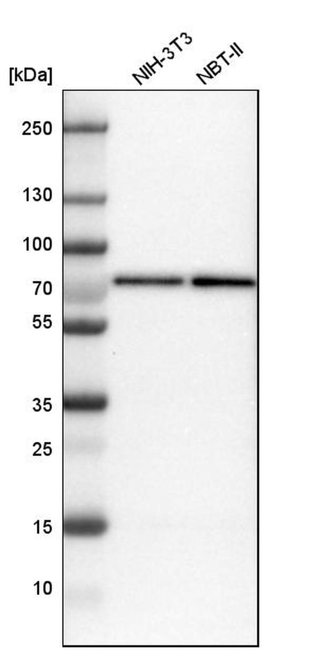 CTPS2 Antibody in Western Blot (WB)