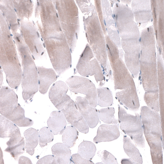 TNRC6A Antibody in Immunohistochemistry (IHC)