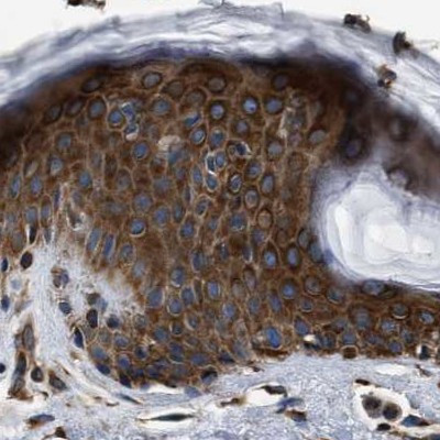 KTN1 Antibody in Immunohistochemistry (IHC)