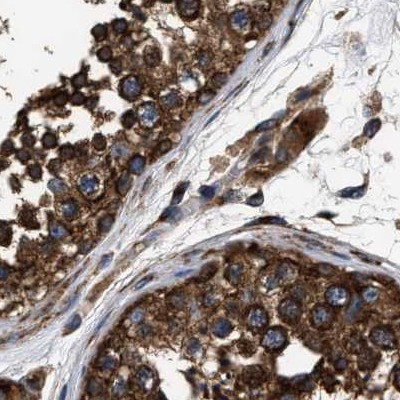 KTN1 Antibody in Immunohistochemistry (IHC)