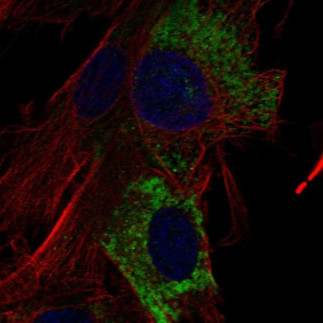 COL15A1 Antibody in Immunocytochemistry (ICC/IF)