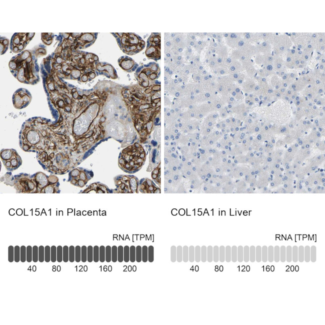 COL15A1 Antibody in Immunohistochemistry (IHC)