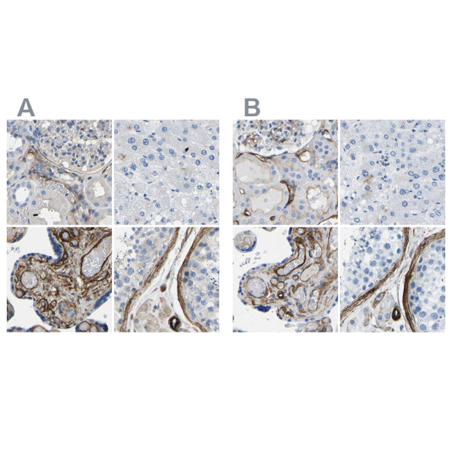 COL15A1 Antibody in Immunohistochemistry (IHC)