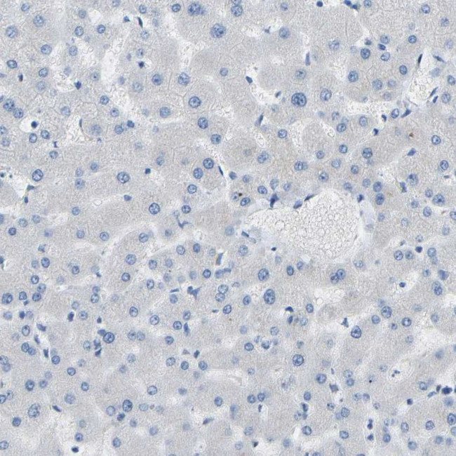 COL15A1 Antibody in Immunohistochemistry (IHC)