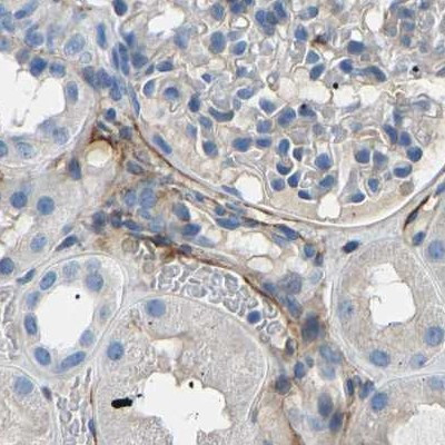 COL15A1 Antibody in Immunohistochemistry (IHC)