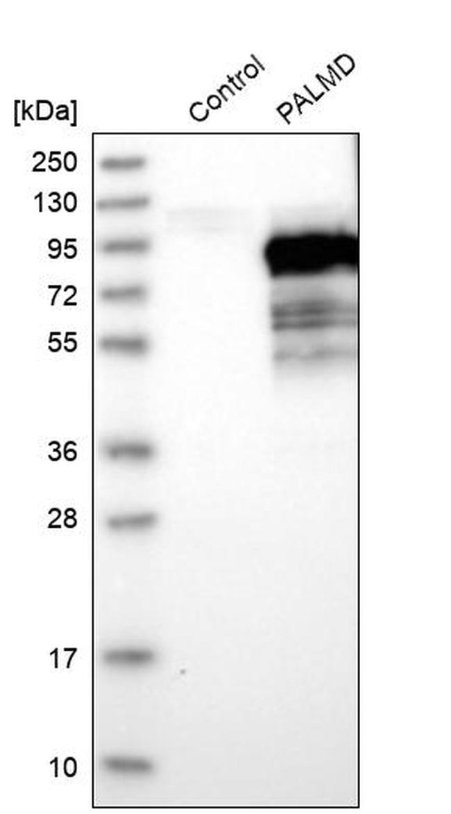 PALMD Antibody in Western Blot (WB)