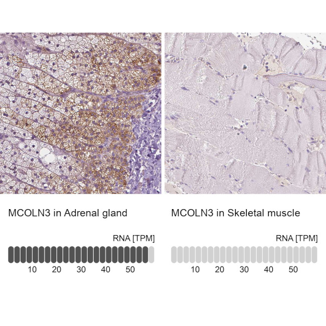 TRPML3 Antibody in Immunohistochemistry (IHC)