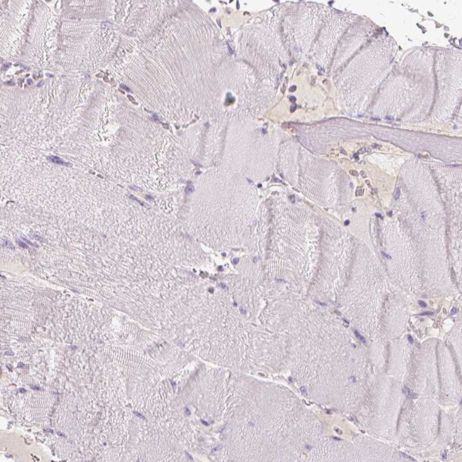 TRPML3 Antibody in Immunohistochemistry (IHC)