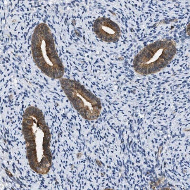 TES Antibody in Immunohistochemistry (IHC)