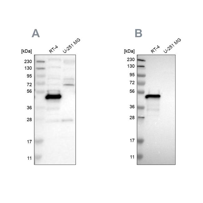 TES Antibody in Western Blot (WB)