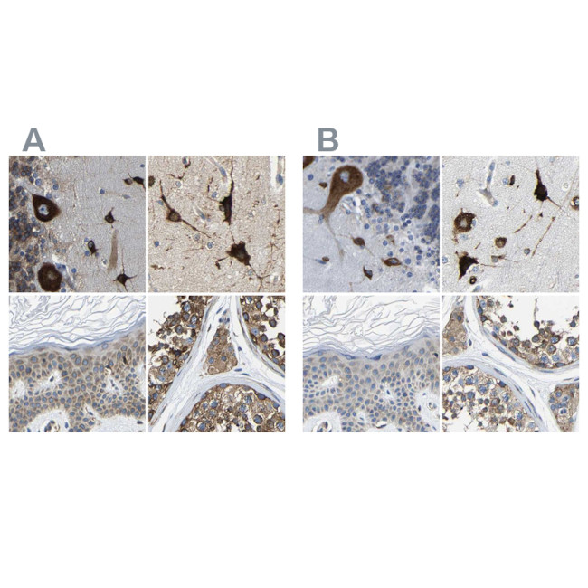 G3BP2 Antibody in Immunohistochemistry (IHC)