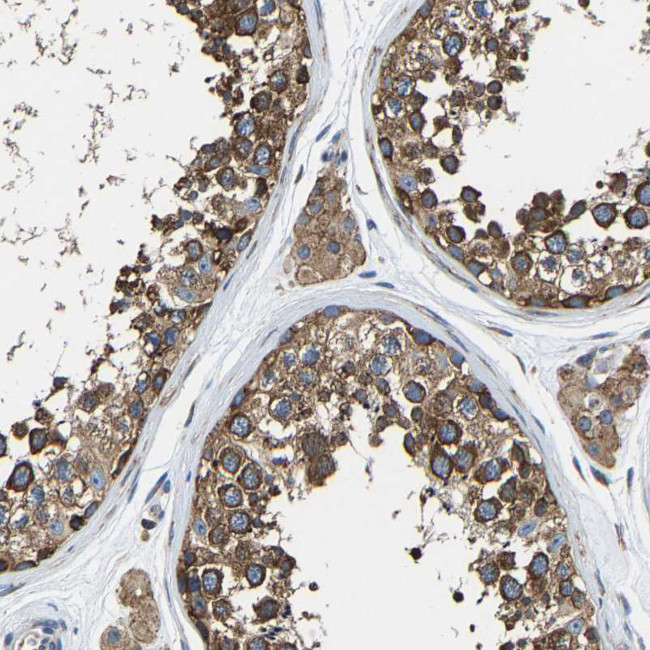 G3BP2 Antibody in Immunohistochemistry (IHC)