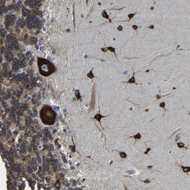 G3BP2 Antibody in Immunohistochemistry (IHC)