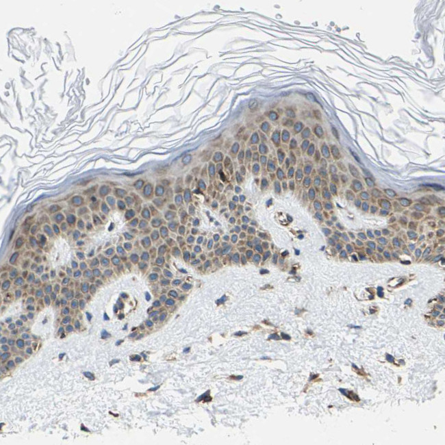 G3BP2 Antibody in Immunohistochemistry (IHC)