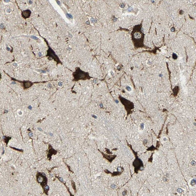 G3BP2 Antibody in Immunohistochemistry (IHC)