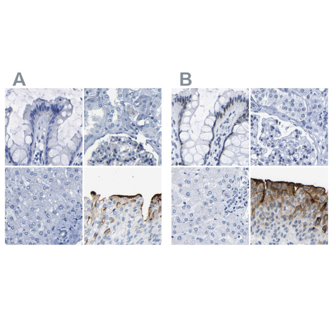 UPK3A Antibody in Immunohistochemistry (IHC)