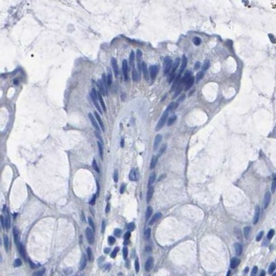 UPK3A Antibody in Immunohistochemistry (IHC)