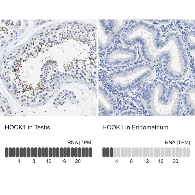 HOOK1 Antibody in Immunohistochemistry (IHC)