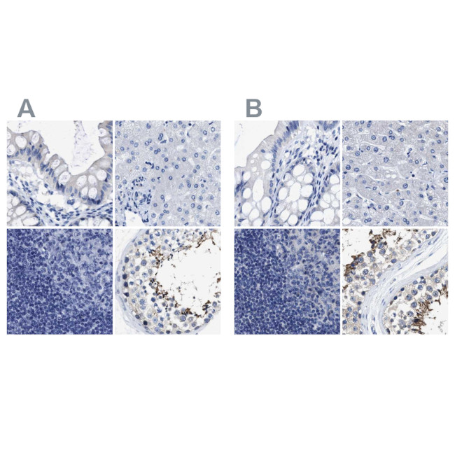 HOOK1 Antibody in Immunohistochemistry (IHC)