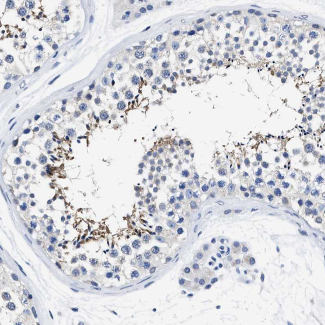 HOOK1 Antibody in Immunohistochemistry (IHC)