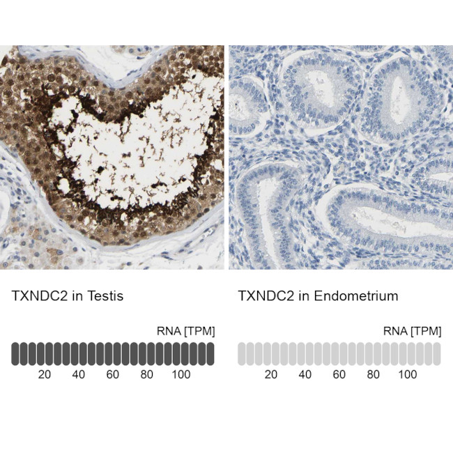 TXNDC2 Antibody in Immunohistochemistry (IHC)