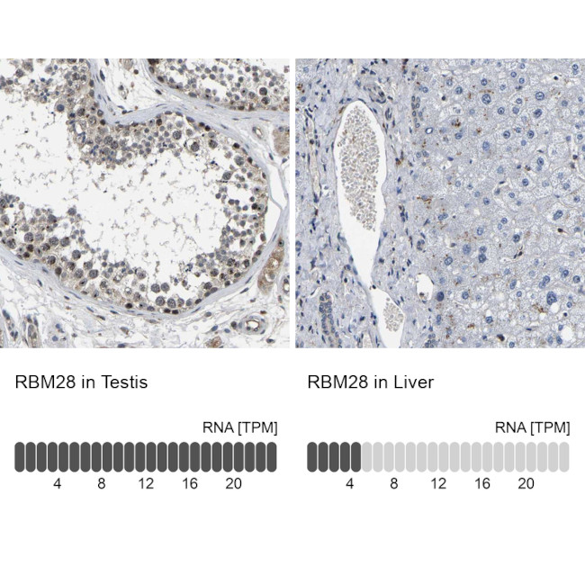 RBM28 Antibody