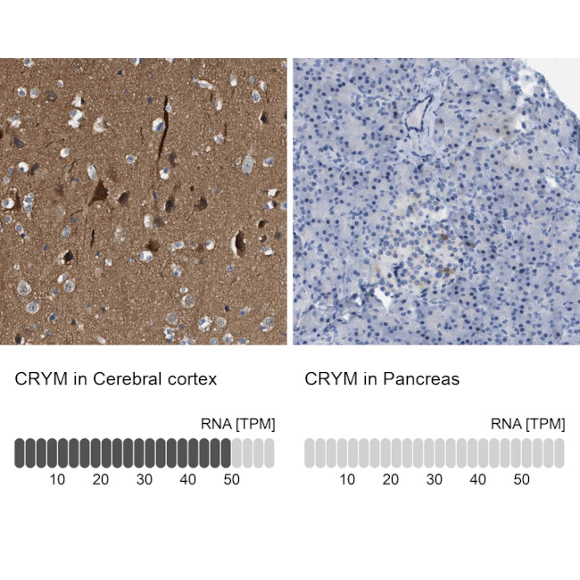 CRYM Antibody in Immunohistochemistry (IHC)