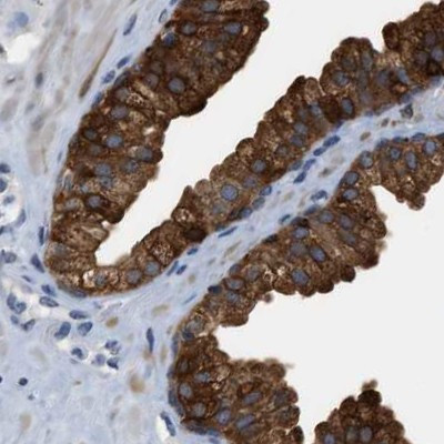 CRYM Antibody in Immunohistochemistry (IHC)