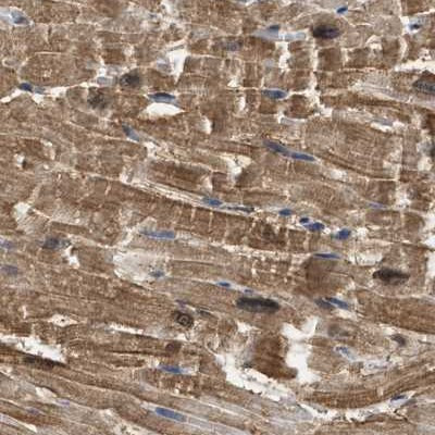 CRYM Antibody in Immunohistochemistry (IHC)