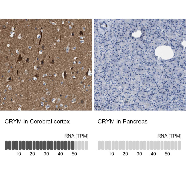 CRYM Antibody