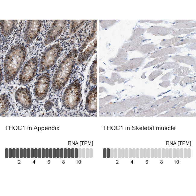 Nuclear Matrix Protein p84 Antibody in Immunohistochemistry (IHC)