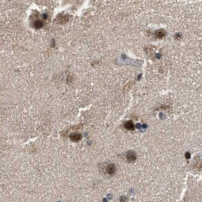 Nuclear Matrix Protein p84 Antibody in Immunohistochemistry (IHC)