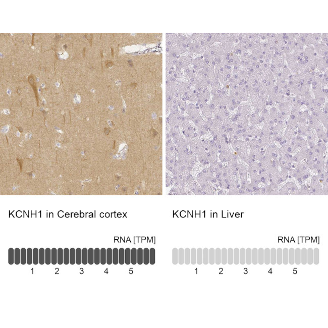 KCNH1 Antibody in Immunohistochemistry (IHC)