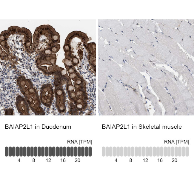 BAIAP2L1 Antibody in Immunohistochemistry (IHC)