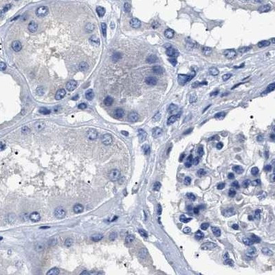 HEMGN Antibody in Immunohistochemistry (IHC)